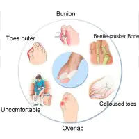 Silicone Toe Aligner and Bunion Relief