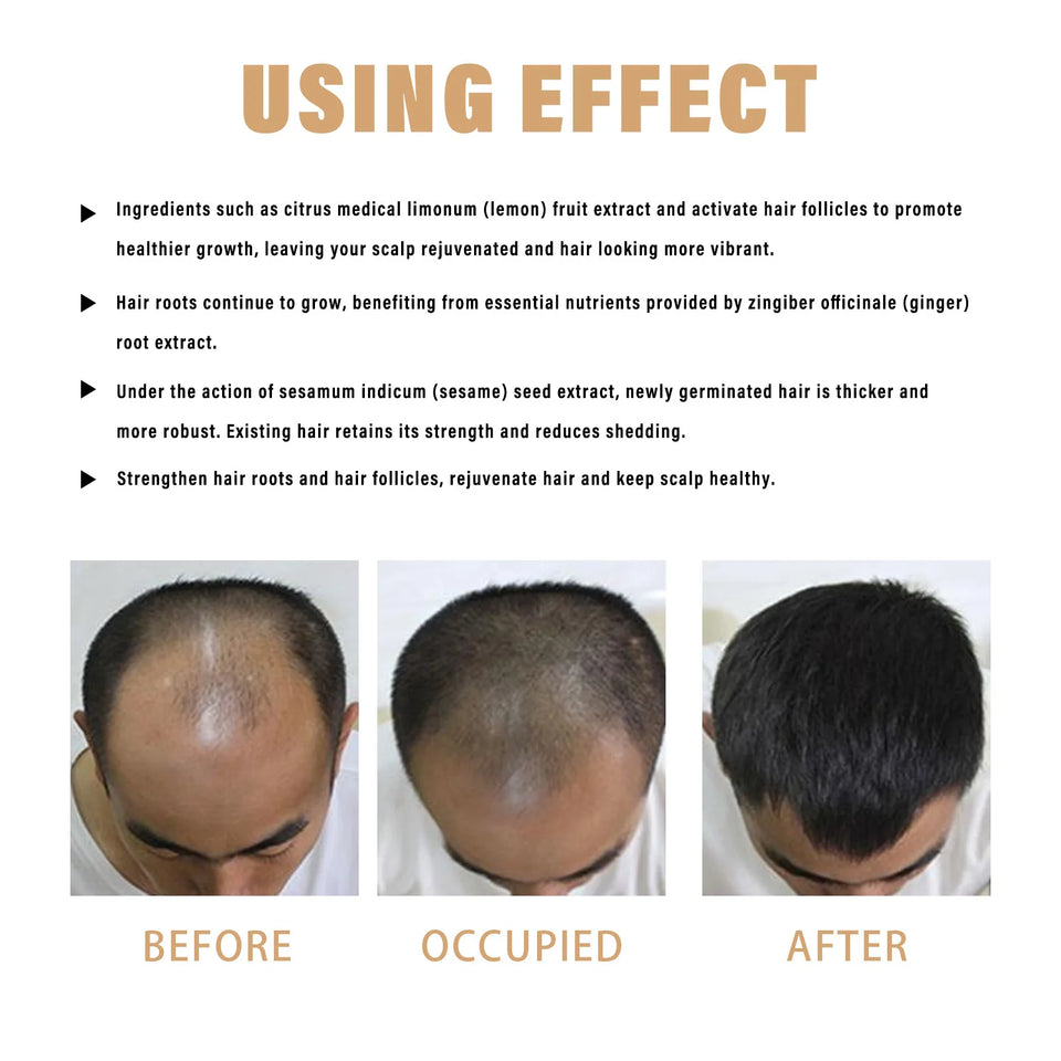 East Moon 100ml Hair Regrowth Shampoo Repair Dry Frizzy Nourishes Scalp Anti Hair Loss Baldness Strengthen Hair Boost Shampoo