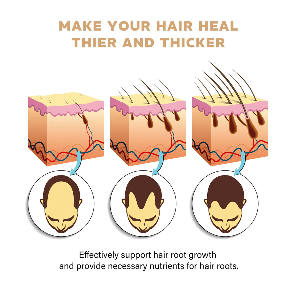 East Moon 100ml Hair Regrowth Shampoo Repair Dry Frizzy Nourishes Scalp Anti Hair Loss Baldness Strengthen Hair Boost Shampoo
