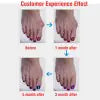 Silicone Toe Aligner and Bunion Relief