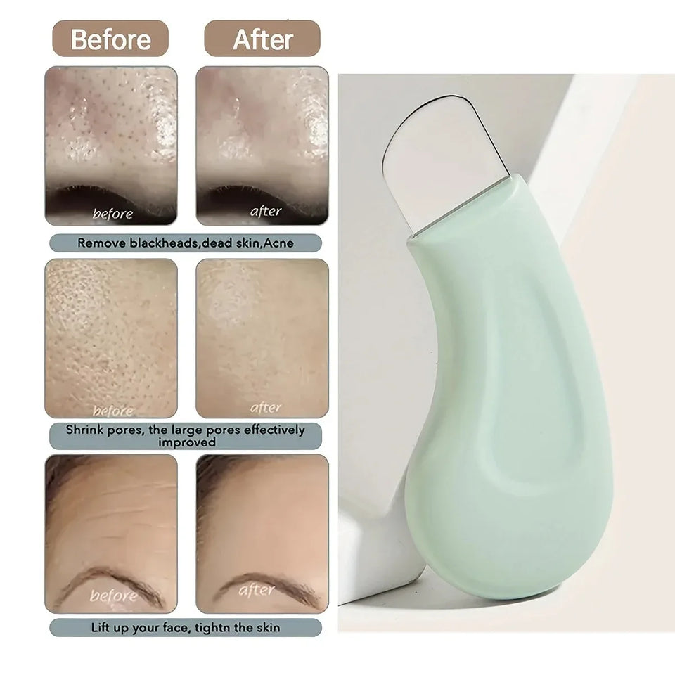 Facial Skin Cleansing Blackhead Removal Tool Nose Deep Cleansing Acne Removal Tool Handheld Beauty Care Tool for Skin Care