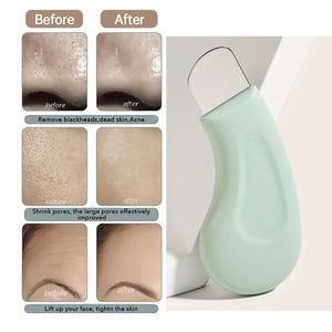 Facial Skin Cleansing Blackhead Removal Tool Nose Deep Cleansing Acne Removal Tool Handheld Beauty Care Tool for Skin Care