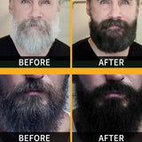 White Hair Dye Shampoo Soap Restore Gray Beard Hair Natural Color White To Black Repair Darken Hair Fixing Shampoo Bar for Women