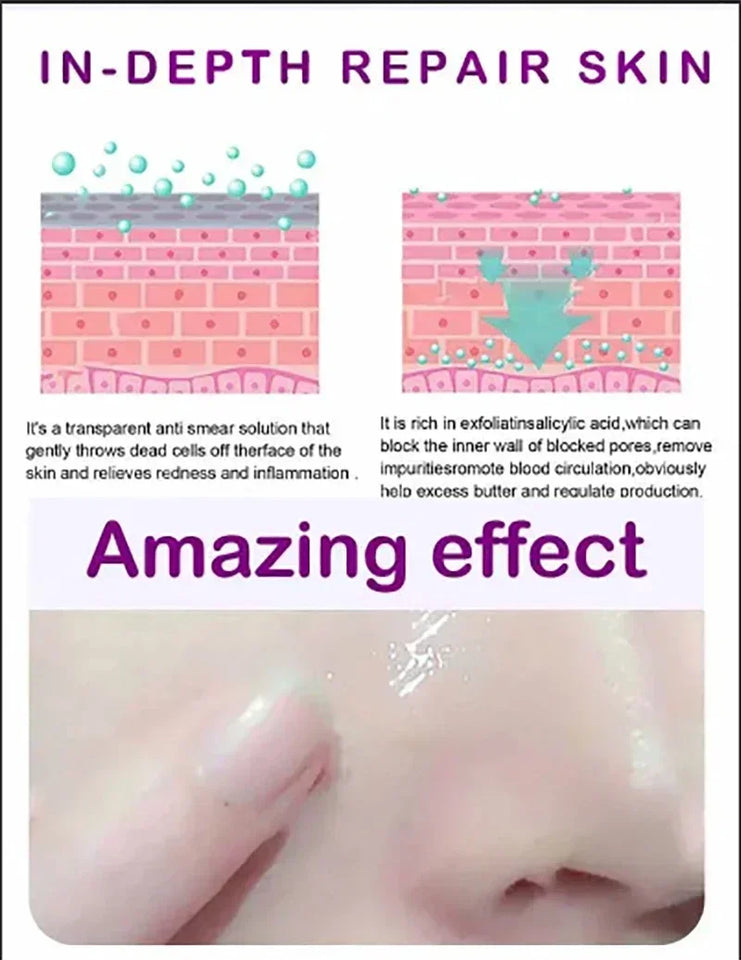 Pore Shrinking Serum Moisturizing Facial Essence for Relieving Dryness Oil Long-lasting Calming for Sensitive Skin Care