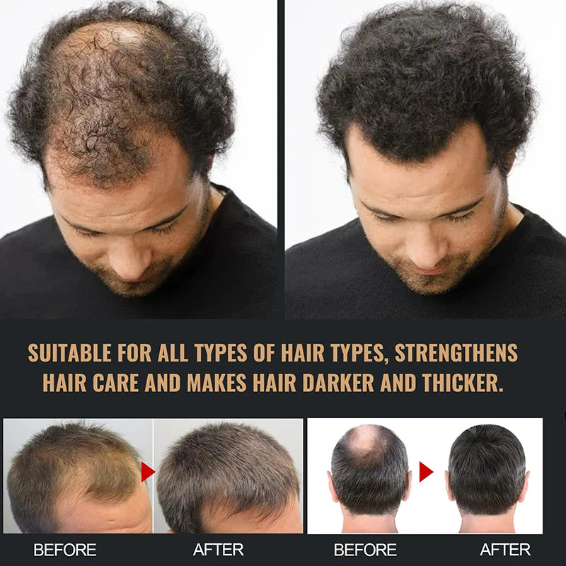 Thickening Hair Shampoo Nourishes Roots And Prevents Shampoos Thickening, Supple, Strong And Repairing Hair Shampoo