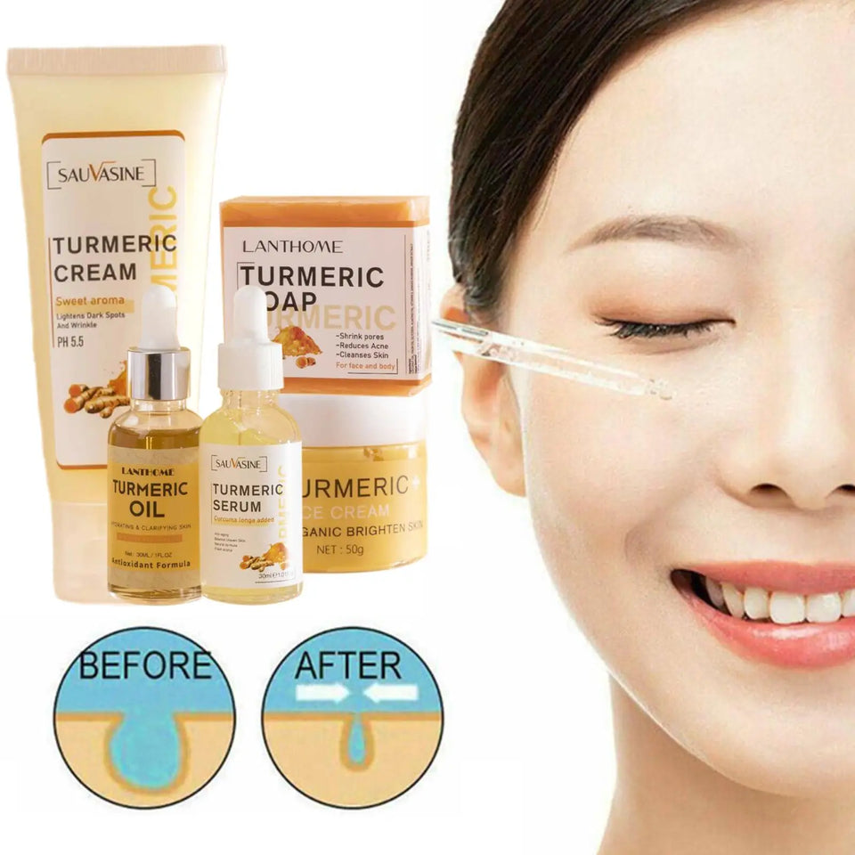 Turmeric Facial Acne Cleansing Cream