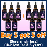 Hair growth essential oil, anyone with baldness and hair loss should buy this product. It has helped millions of people say good