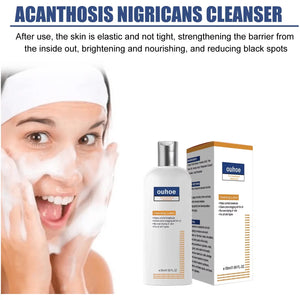 Whi-tening Facial Cleanser Remove Melasma D-ark Sp-ot Pigmentation Anti Acne Deep Moisturizing Brightening Smooth Face Skin Care