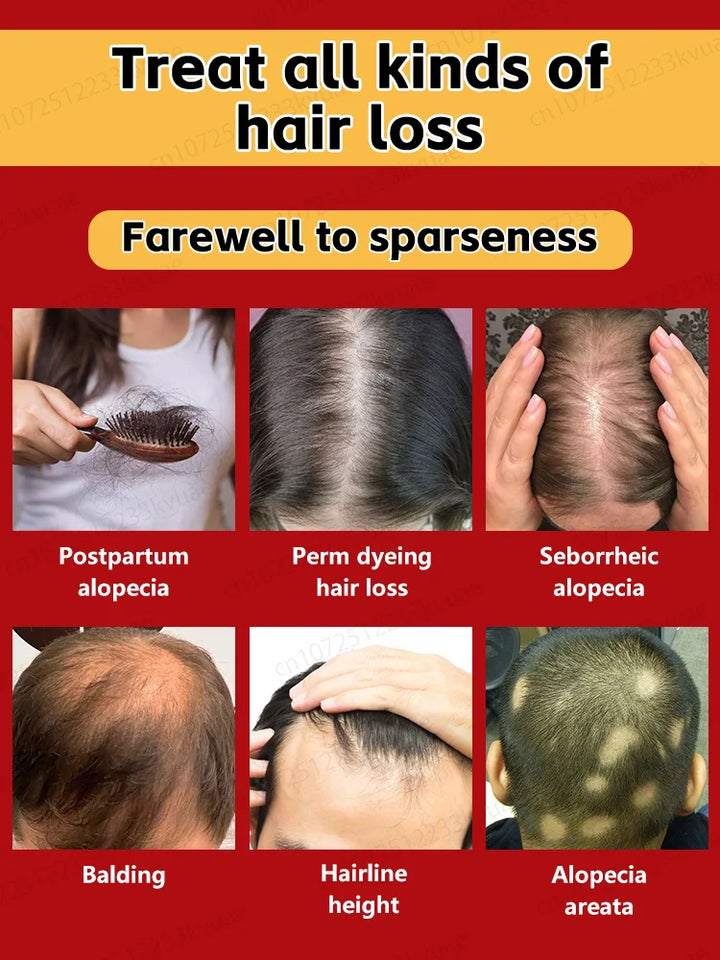 Hair growth essential oil, anyone with baldness and hair loss should buy this product. It has helped millions of people say good