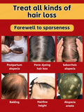 Hair growth essential oil, anyone with baldness and hair loss should buy this product. It has helped millions of people say good