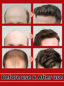 Hair growth essential oil, anyone with baldness and hair loss should buy this product. It has helped millions of people say good