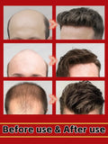 Hair growth essential oil, anyone with baldness and hair loss should buy this product. It has helped millions of people say good