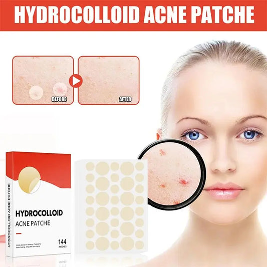 Face Skin Care Acne Pimple Patch 2 Sizes