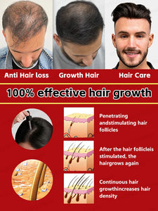 Hair growth essential oil, anyone with baldness and hair loss should buy this product. It has helped millions of people say good