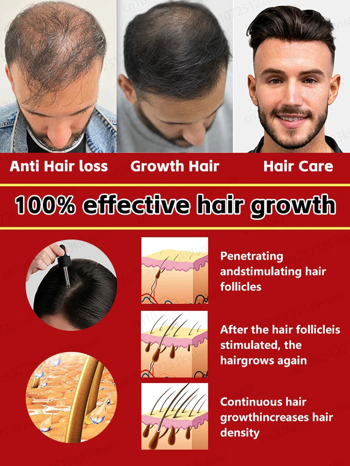 Hair growth essential oil, anyone with baldness and hair loss should buy this product. It has helped millions of people say good