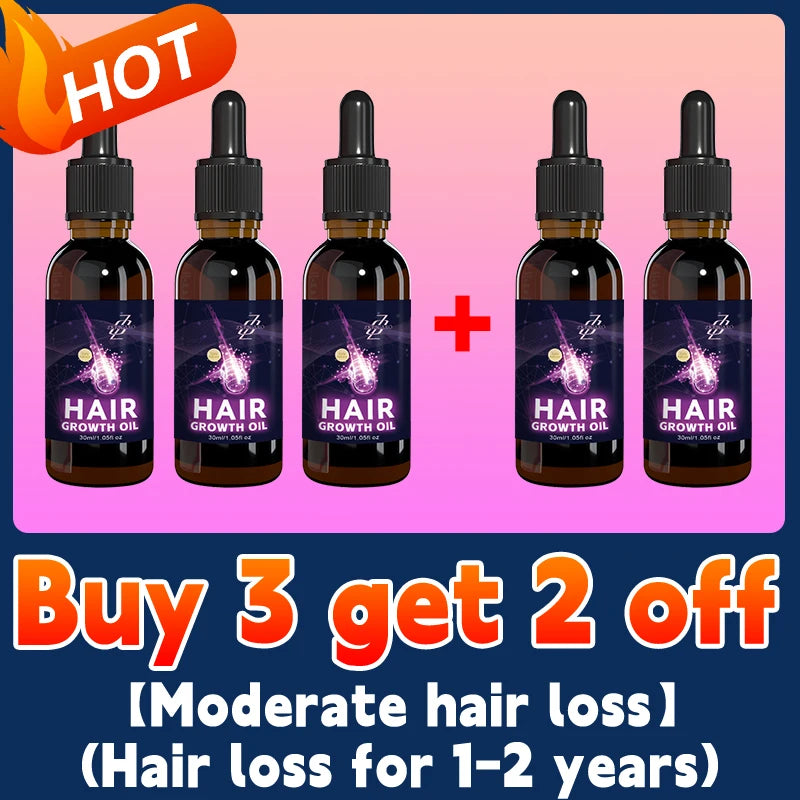 Hair growth essential oil, anyone with baldness and hair loss should buy this product. It has helped millions of people say good