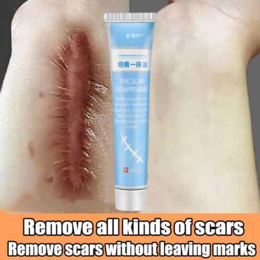 Scar Removal Cream Repair Burns Scalding Surgery Stretch Marks Old Scars