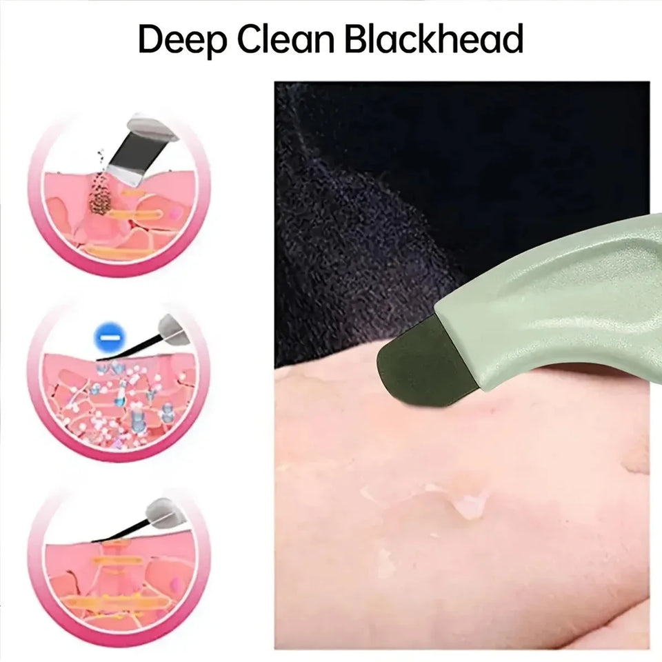 Facial Skin Cleansing Blackhead Removal Tool Nose Deep Cleansing Acne Removal Tool Handheld Beauty Care Tool for Skin Care