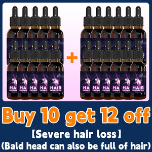 Hair growth essential oil, anyone with baldness and hair loss should buy this product. It has helped millions of people say good