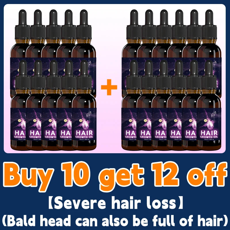 Hair growth essential oil, anyone with baldness and hair loss should buy this product. It has helped millions of people say good
