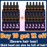 Hair growth essential oil, anyone with baldness and hair loss should buy this product. It has helped millions of people say good