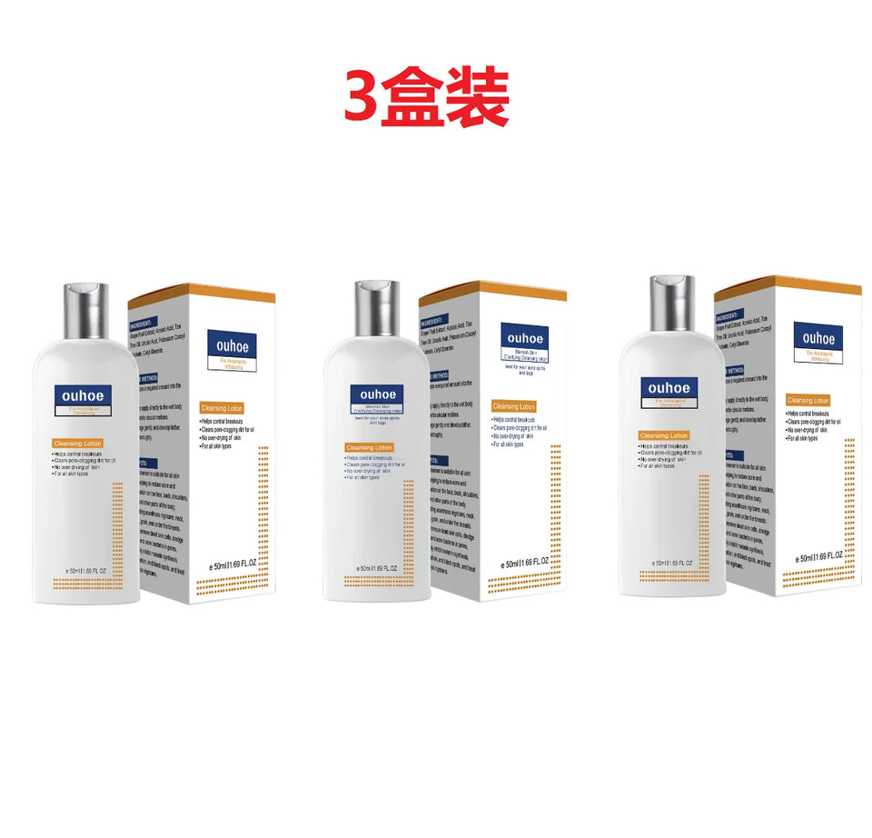 Whi-tening Facial Cleanser Remove Melasma D-ark Sp-ot Pigmentation Anti Acne Deep Moisturizing Brightening Smooth Face Skin Care