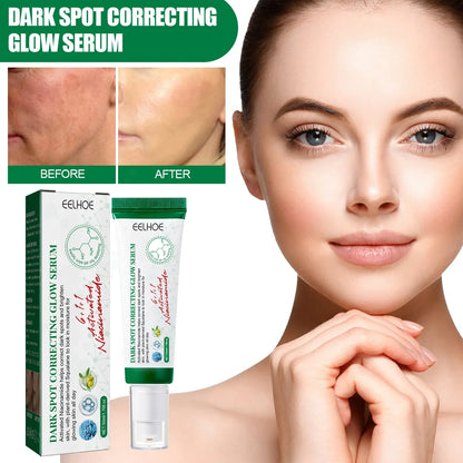 Dark Spot  Skin Nourishing Day Cream