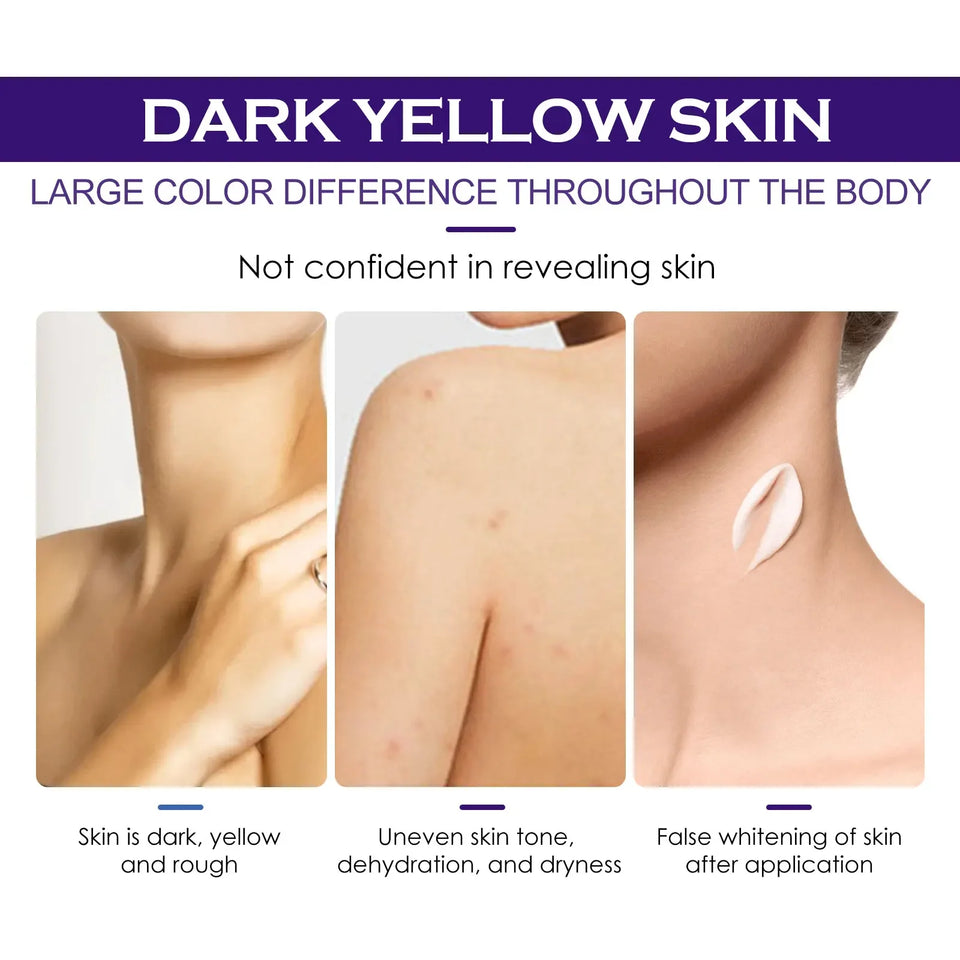 5 packs Niacinamide Whitening Body Lotion Improving Dull Skin Brightening Complexion Nourishing & Moisturizing Body Care Product