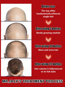 Hair growth essential oil, anyone with baldness and hair loss should buy this product. It has helped millions of people say good